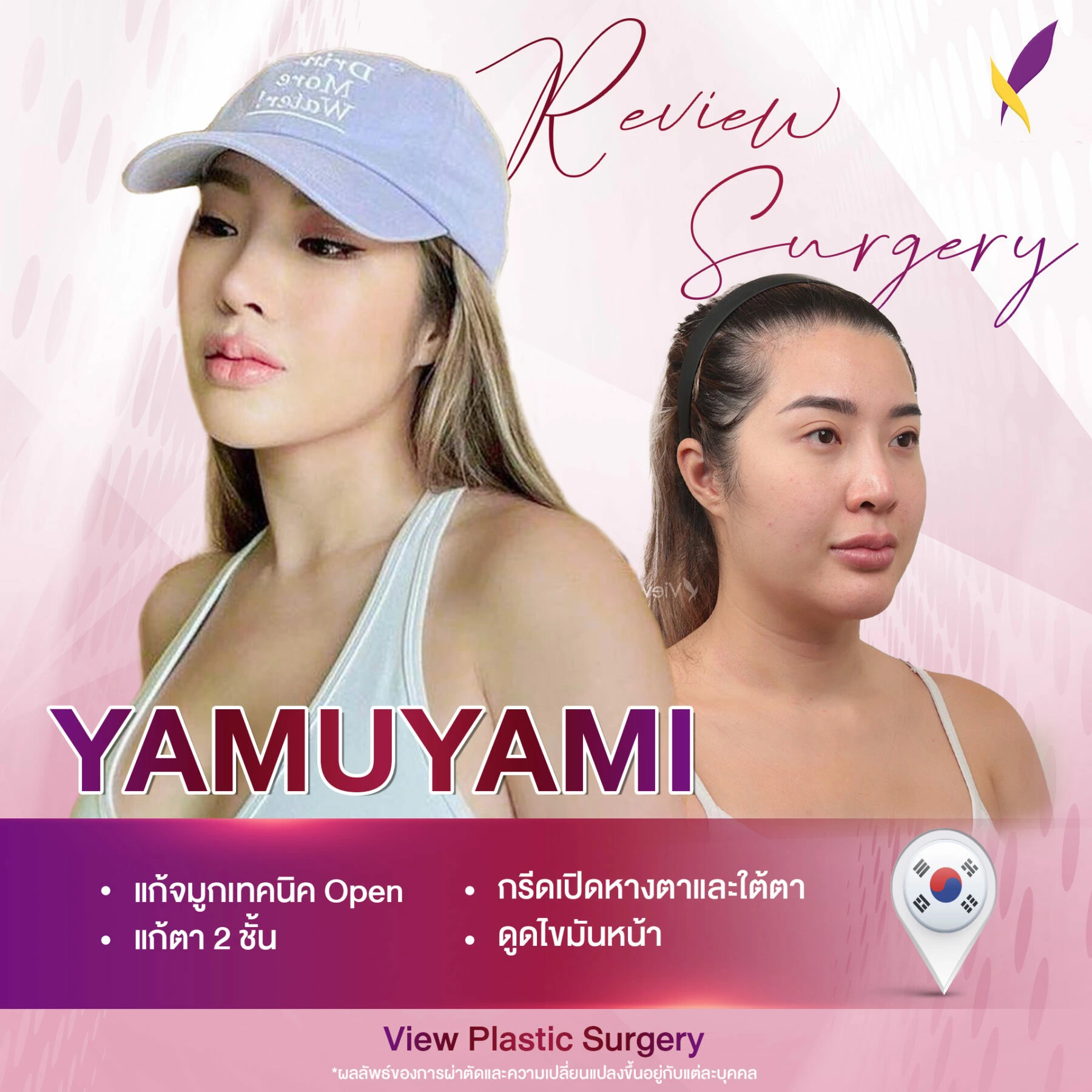 450880886_122157021284178082_5807598543024809162_n