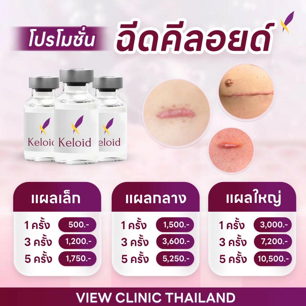 LINE_ALBUM_โปรโมชั่น เดือน พ.ค._251210_21